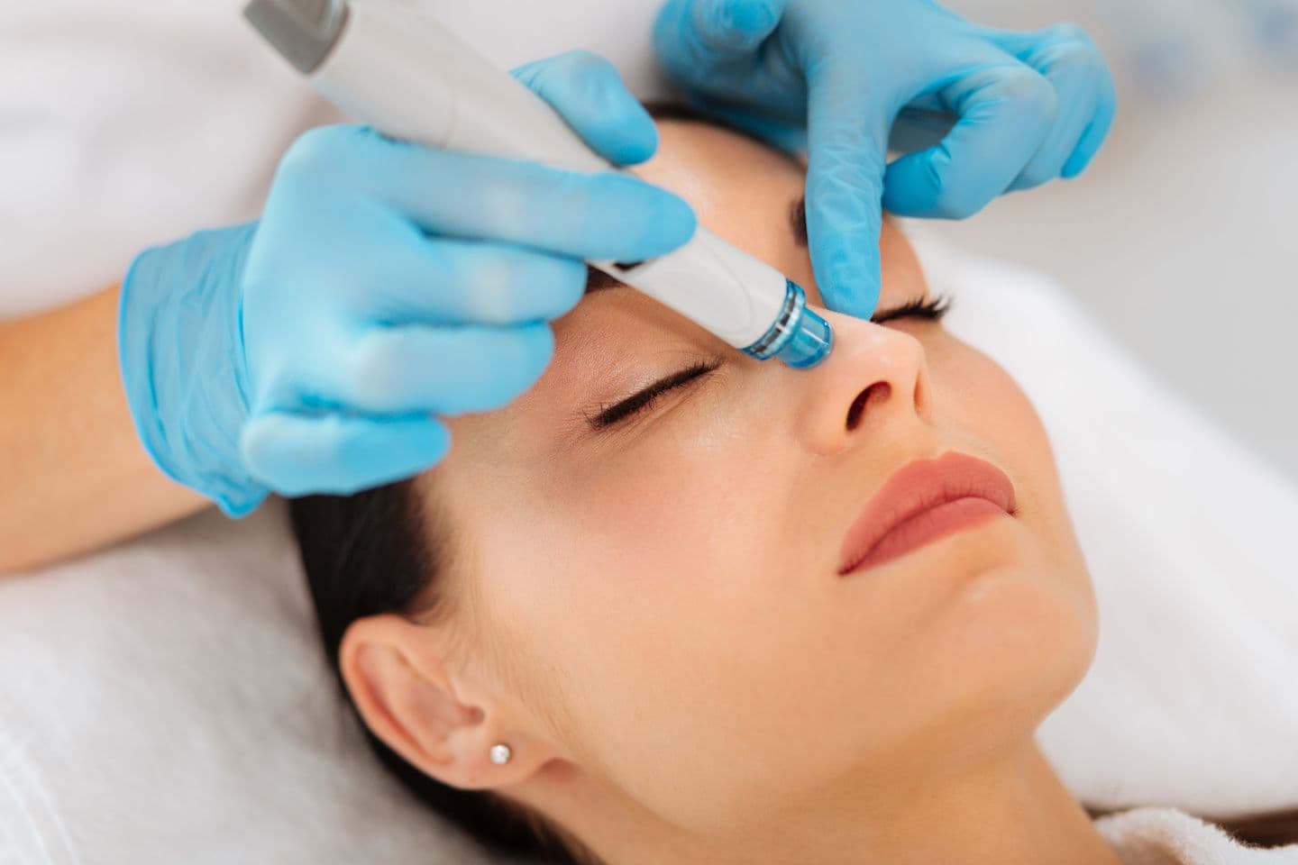 Hydrafacial Treatment Galway Skin Clinic 8059